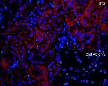 Il1rl1 Antibody