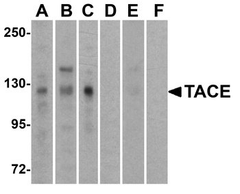 ADAM17 Antibody
