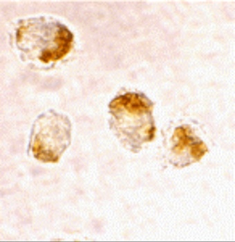 BAX Antibody