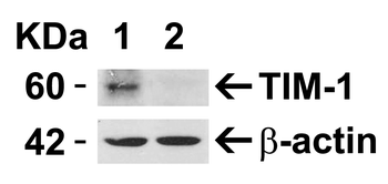 HAVCR1 Antibody