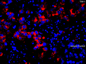 HAVCR1 Antibody
