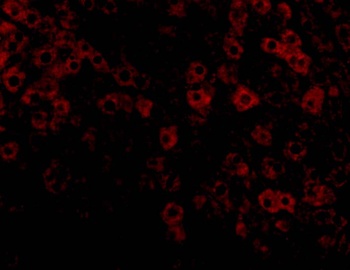 PLIN3 Antibody