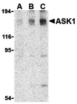 MAP3K5 Antibody