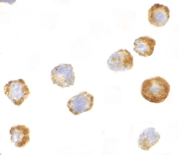 MAP3K5 Antibody