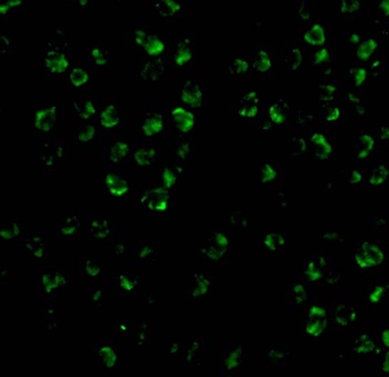 MAP3K5 Antibody