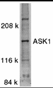 MAP3K5 Antibody