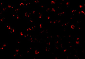 MAP3K5 Antibody