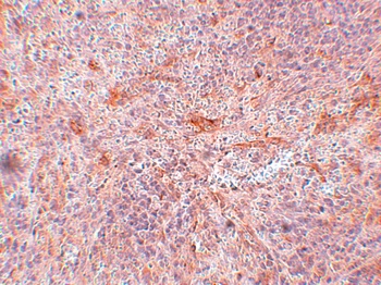 TNIP3 Antibody