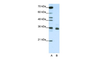 HNRNPA1L2 Antibody