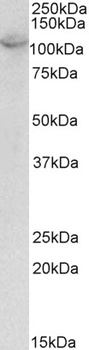 CLIC1/NCC27 Antibody