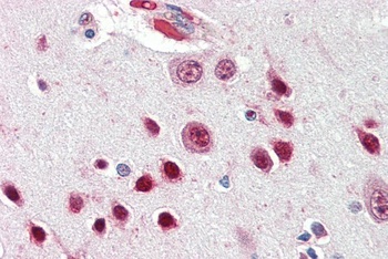 NOVA1 Antibody
