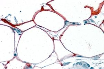 ILF2 Antibody