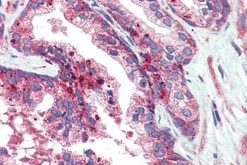 VPS35 Antibody