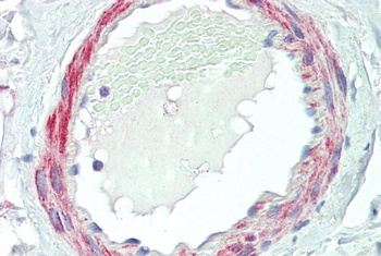 VPS35 Antibody