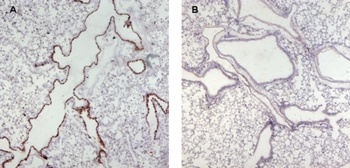 UNC13D Antibody