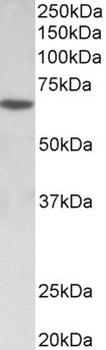CDH1 Antibody