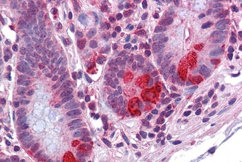 PLIN Antibody