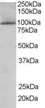 TAOK3 Antibody