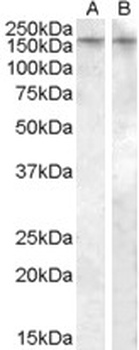 IRAK3 Antibody