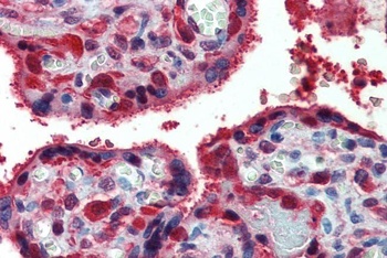 PRDX1 Antibody