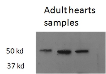 GRIK1 Antibody