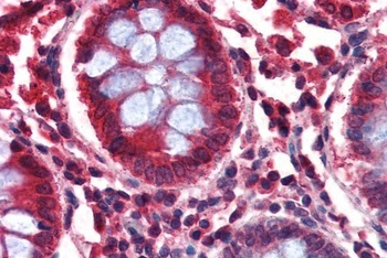 GAD2 Antibody
