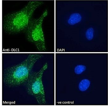 DLC1 Antibody