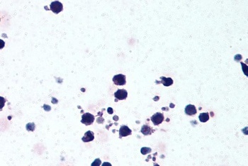NLRP3 Antibody