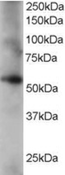 CORO1C Antibody