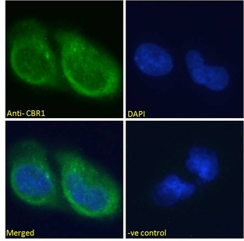 CBR1 Antibody