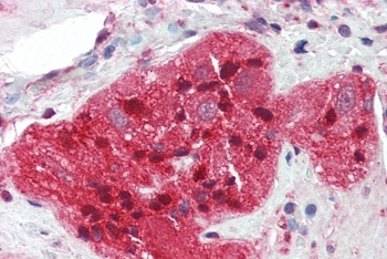 STMN2 Antibody