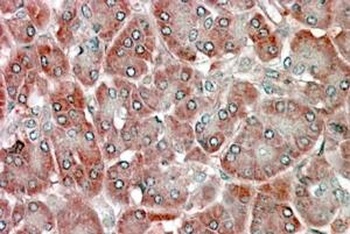 RBP1 Antibody
