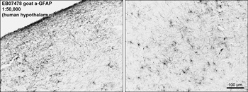 GFAP Antibody