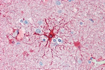 GFAP Antibody