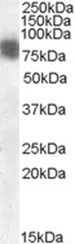 CTTN Antibody