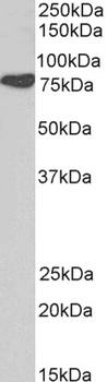 CTTN Antibody