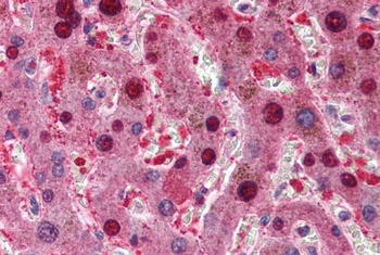 CDKN2A Antibody