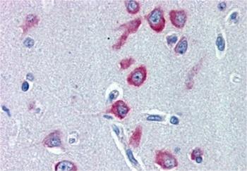 CDKN2A Antibody