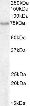 BLNK Antibody