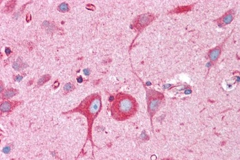 BCAP31 Antibody