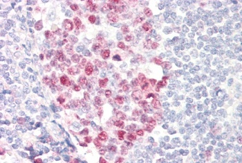 CXCR7/RDC1 Antibody