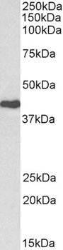 cardiac troponin T Antibody