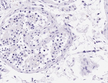 CD3D Antibody