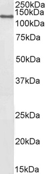 SERPINF1/PEDF Antibody