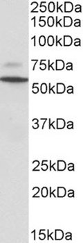 tropomyosin 4/TPM4 Antibody