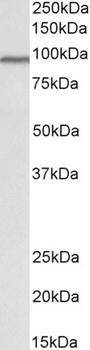 tropomyosin 4/TPM4 Antibody