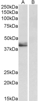 ATP5A1 Antibody