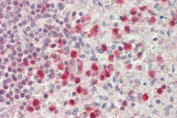 ATP5A1 Antibody