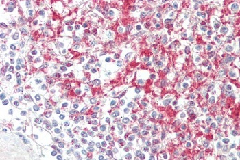 keratin 18 Antibody