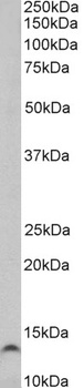 keratin 18 Antibody